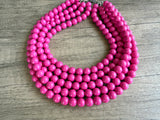 Bright Pink Acrylic Big Beaded Chunky Multi Strand Necklace - Alana